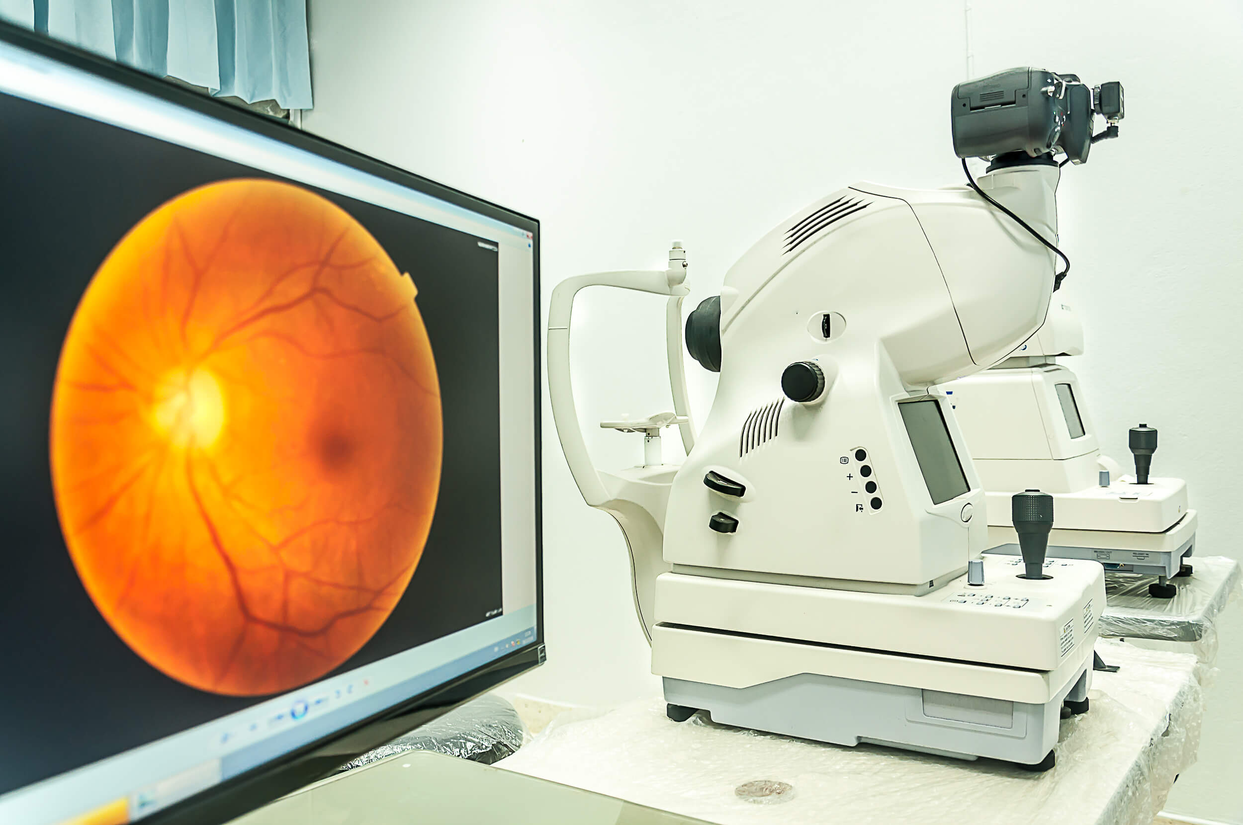 What is diabetic eye screening?